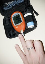 Measurement of the glucose mirror in the blood to correct insulin doses with 1 type of diabetes